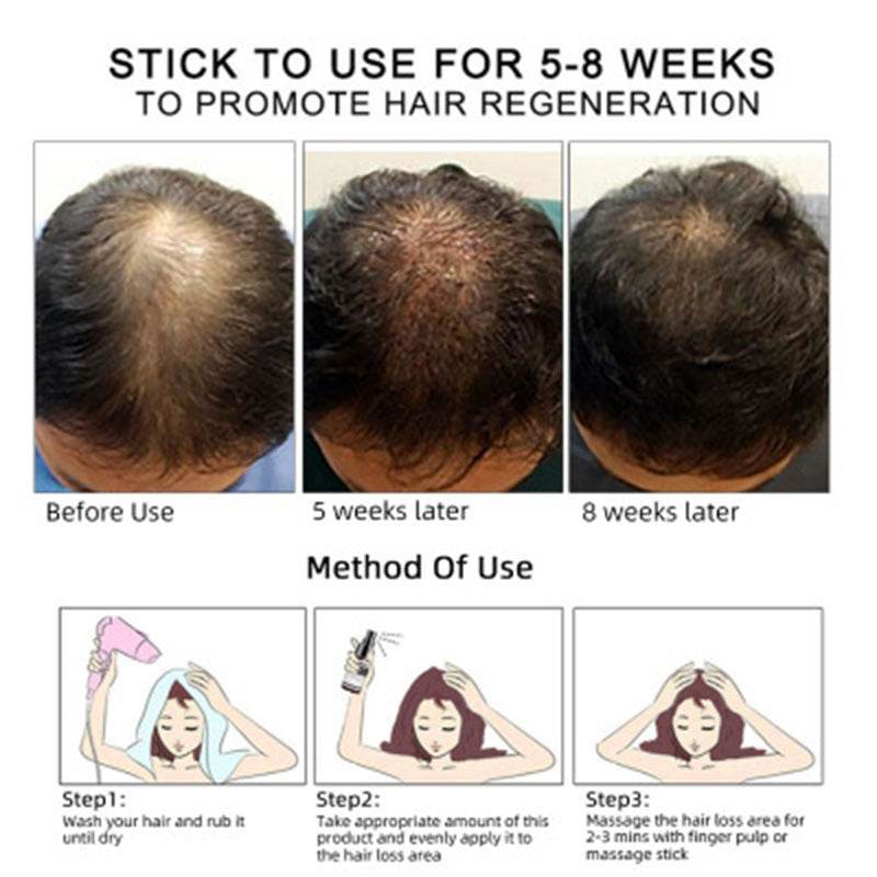 Hair Growth Oil – Effective Hair Care for Healthy, Strong Hair - Pasha